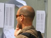 Combattre la calvitie Combattre la calvitie