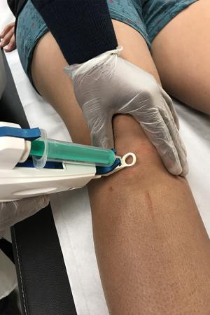 injection mésothérapie injection mésothérapie